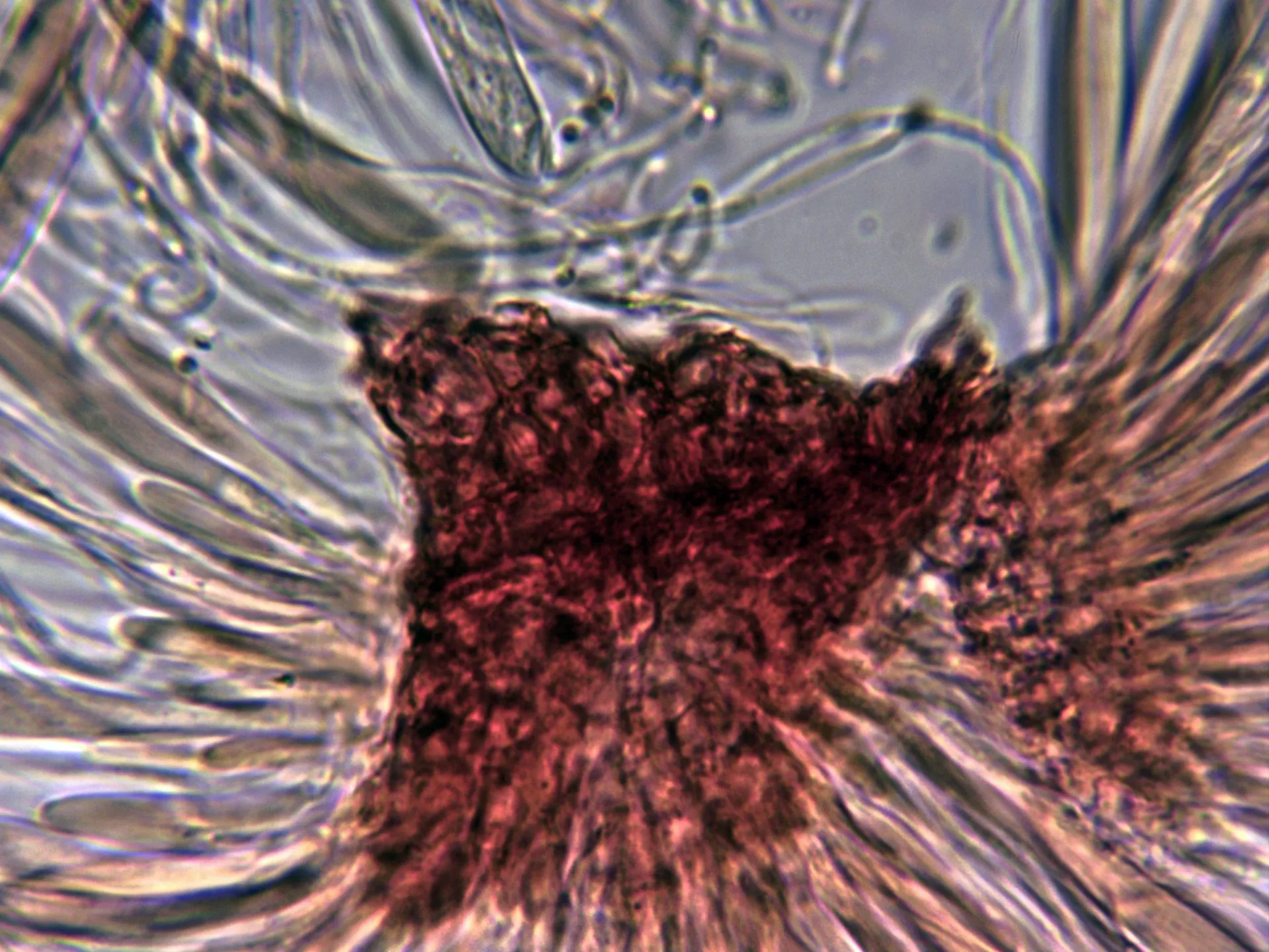 Microscopía de Lophodermium petiolicola - 15 - Excípulo